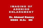 Dr ahmed esawy imaging of adeniod enlargment