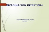 Invaginacion intestinal en pediatria