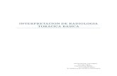 (2012-01-24)Interpretacion de radiologia toracica basica.doc
