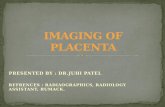 Imaging of placenta
