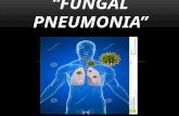 Fungal pneumonia