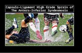 Syndesmotic Injury in a Professional Football Player