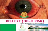 Red eye (high risk) by thann