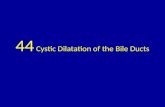 44 cystic dilatation of the bile ducts