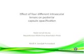 Effect of four different intraocular lenses on posterior