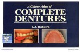 A color atlas of complete dentures