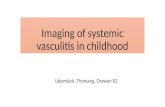 Pediatric vasculitis
