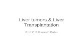 Liver tumors & liver transplantation