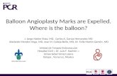 BALLON ANGOPLASTY MARKS ARE EXPELLED. GUIDELINER IN COMPLEX CASE
