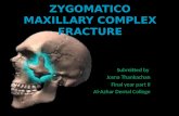 Zygomatic maxillary complex fracture
