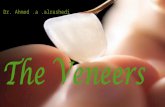 the Veneer step by step