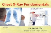 Chest x ray fundamentals