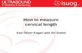 How to measure cervical length