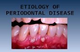 Etiology of periodontal disease
