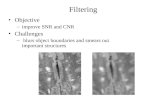 Filtering Objective –improve SNR and CNR Challenges – blurs object boundaries and smears out important structures.