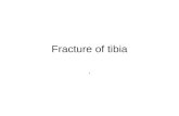 Fracture of tibia ..