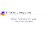Thoracic Imaging Chest Radiography and other techniques.