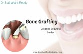 Dental Bone Graft in Bangalore | Dental Implant Centre In India