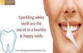 Teeth Whitening Treatment In Chennai | Best Dental Clinic In Tamilnadu