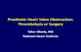 Prosthetic heart valve obstruction