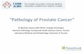 Pathology of Prostate Cancer - canm-acmn.ca Speaker Presentations/2017 PET... · Pathology of Prostate Cancer _ Dr Michelle Downes MD FRCPC, Urologic Pathologist ... –↑ Gleason