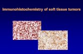 Immunohistochemistry of soft tissue tumors - epathologiesepathologies.com/sem/tm05/IHC_SA_Bey05.pdf · Immunohistochemistry • Future of IHC is promising ... Ancient schwannoma ...