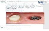 bicaion b y u i Adhesive Restorations in the nt esen c e o ... · PDF filebuildup, onlay preparation, ... Direct techniques are indicated for Class I ... 3% amalgam, 2.2% direct composites,