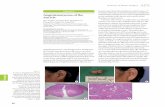 Angioleiomyoma of the Auricle - e-aps.orge-aps.org/Synapse/Data/PDFData/2023APS/aps-40-68.pdf · Aufrecht E. Ein myom der vena saphena. Virchows Arch Pathol Anat Physiol Klin Med