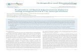 Evaluation of Spinal Ligamentous Injuries using ...juniperpublishers.com/oroaj/pdf/OROAJ.MS.ID.555551.pdf · Evaluation of Spinal Ligamentous Injuries using Computerized ... Evaluation