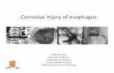 Corrosive injury of esophagus BW.ppt - HKSUGIS injury of esophagus BW1.… · Corrosive injury of esophagus Philip WY Chiu Associate Professor Department of Surgery Prince of Wales
