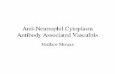 Anti-Neutrophil Cytoplasm Antibody Associated Vasculitis · PDF fileMicrosoft PowerPoint - Lunchtime Talk.ppt Author: karimar Created Date: 12/13/2005 12:15:57