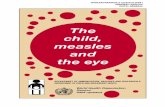 The child, measles and the eye - World Health · PDF filechild, measles and the eye. 2 ... the eyes of children.1 Understanding the risks of damage to the eye from ... that no weight