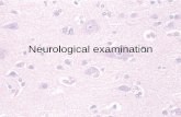 Neurological examination - The Hillingdon Hospitals NHS ... · PDF file☤Aim of neurological examination is to locate the lesion ☤Aim of neurological history is to determine lesion