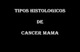 TIPOS HISTOLOGICOS DEL CANCER MAMA - seom.org · PDF filecancer de mama clasificacion histologica la clasificacion histologica extensa, laboriosa pero: - no explica la diversidad de