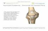 Synovial Problems - Removal Of Painful Plica · PDF file Removal of Painful Plica Introduction The synovial membrane is found in joints like your knee and shoulder. This thin membrane
