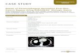 Repair of Paraesophageal Herniation Post Mini- Gastric ... · PDF fileCASE STUDY PARAESOPHAGEAL HERNIA Repair of Paraesophageal Herniation Post Mini- Gastric Bypass Using MIROMESH™