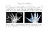 How to Rehabilitate a Broken - Pennsylvania State …sites.psu.edu/.../2013/04/How_to_Rehabilitate_a_Broken.pdfHow to Rehabilitate a Broken Hand Post Operation Introduction: The Mayo