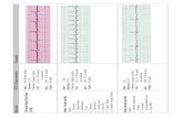 EKG Flash Chart - Santa Fe College · PDF fileRhythm ECG Characteristics Example Normal Sinus Rhythm (NSR) Rate: 60-100 per minute 0.04 – 0.10 second Rhythm: R- R = P waves: Upright,