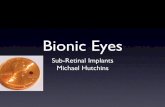 Bionic Eyes - hansmalab.physics.ucsb.edu Eyes Sub-Retinal Implants Michael Hutchins. Motivation • Retinal diseases cannot be ﬁxed with normal corrective procedures. • Vision