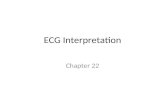 ECG Interpretation - Eastern Illinois Universitycfje/5250/12b-Interptret… · PPT file · Web view · 2011-05-04ECG Interpretation Chapter 22 ECG ... delta wave ECG Waves QRS width
