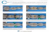 Dr. MARCO VENEZIANI lass direct posterior composite ... · PDF fileClass II carious lesions on teeth 45 and 46 Isolation ... II direct posterior composite restorations Composite adhesive