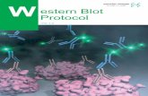 Western Blot Protocols Original - · PDF fileSample: 1. Protein Markers (Product No. 29458-24) 2. Human Serum 3. Pre-stained Protein Markers (Broad Range) (Product No. 02525-35) Membrane: