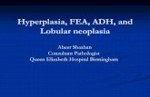 Hyperplasia, FEA, ADH, and Lobular neoplasia - bdiap.orgbdiap.org/wp-content/uploads/2017/12/Shaaban_Abeer.pdf · Hyperplasia, FEA, ADH, and Lobular neoplasia Abeer Shaaban Consultant