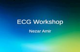 ECG Workshop - Heart Group GP/ECG... · ECG Workshop Nezar Amir. Myocardial Ischemia . ... exam is otherwise normal. 1. ... murmur along the left sternal border and a wide splitting