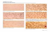 HEMATOLOGY Hematocrit and Smear - · PDF fileHEMATOLOGY Hematocrit and Smear Page 1 of 1 ... myeloid and neutrophil stages. A LAP ... PHILS with 2 symmetric round/oval nuclear lobes