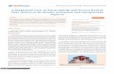 A Diagnosed Case of Anencephaly and Severe Neural Tube …medcraveonline.com/OGIJ/OGIJ-01-00013.pdf · A Diagnosed Case of Anencephaly and Severe Neural Tube Defect at 30 Weeks, Antenatal