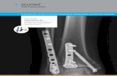 Ankle Plating System - · PDF fileCase Study Jeffrey Seybold, MD ... reduction of the distal fibula fracture was achieved first, and the fracture was temporarily stabilized with a