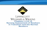 Chapters 13 & 15 Nursing Assessment of Newborn in ...ukiahadultschool.net/uploads/6/6/8/4/66842831/newborn...Chapters 13 & 15 Nursing Assessment of Newborn in Transition and the Normal