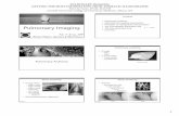 Principles of radiographic interpretation Pulmonary Imaging · PDF file · 2017-09-07– Shallow breathing – Gravity dependent ... – Neonatal respiratory distress syndrome ...
