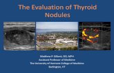 The Evaluation of Thyroid Nodules - University of New · PDF fileAssistant Professor of Medicine ... •Discuss the role of diagnostic imaging in the evaluation of thyroid nodules
